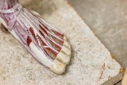 Question 8 photo: Tendons